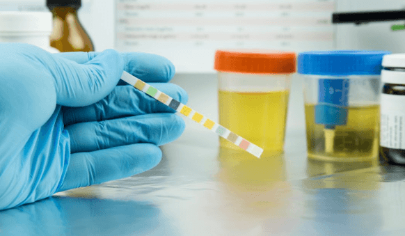 Building a Workplace Drug Screening Program That Doesn't Fall Apart in Six Months