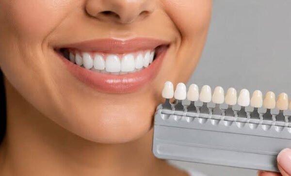 Cosmetic Dentistry For People Who Prefer Gradual Smile Changes