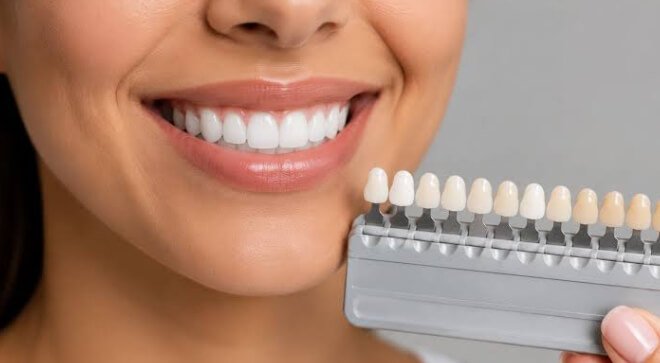 Cosmetic Dentistry For People Who Prefer Gradual Smile Changes