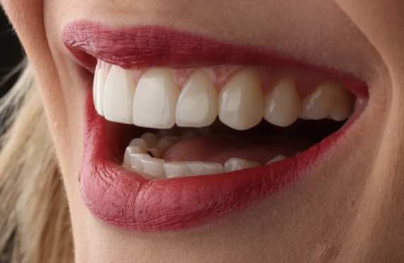 When Minor Tooth Reshaping Can Improve Symmetry Without Adding Dental Material