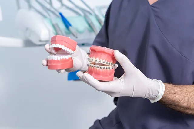 Braces, Clear Aligners, and Busy Family Life in Omaha, Nebraska: A Planning Guide